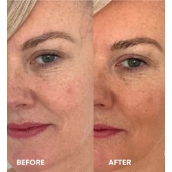 The Serum - Anti Age Face Tan 15 ml.